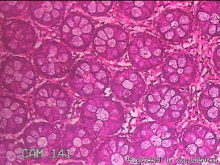 直肠粘膜图18