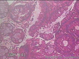 乙状结肠粘膜图8