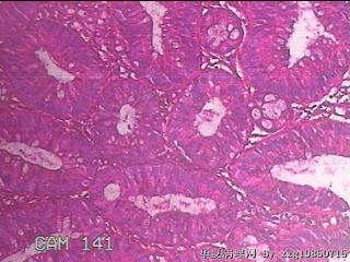 乙状结肠粘膜图20