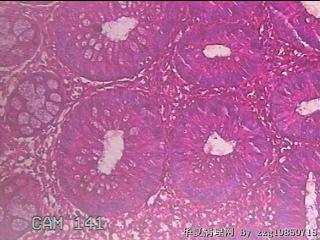 乙状结肠粘膜图9