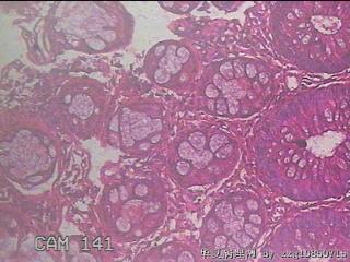 乙状结肠粘膜图7