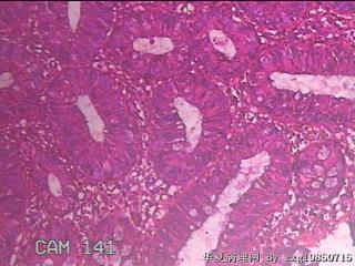 乙状结肠粘膜图22
