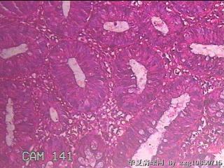乙状结肠粘膜图14