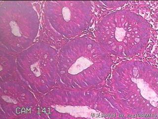 乙状结肠粘膜图19