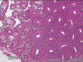 乙状结肠粘膜图2