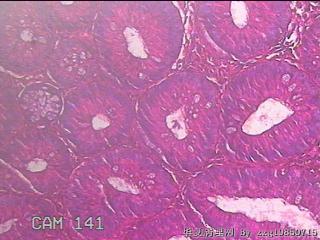 乙状结肠粘膜图17