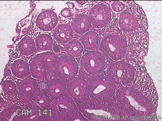 乙状结肠粘膜图6