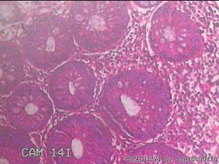 乙状结肠粘膜图18
