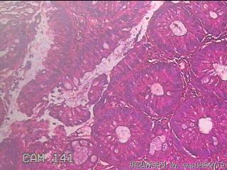 乙状结肠粘膜图10