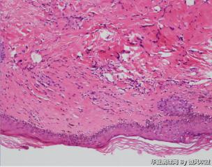 皮肤病理图2