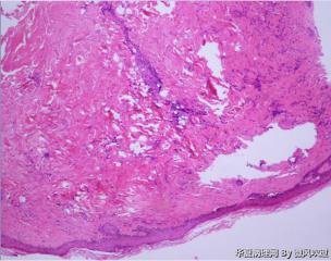 皮肤病理图3