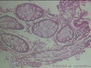 降结肠粘膜图23