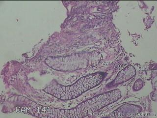 降结肠粘膜图4