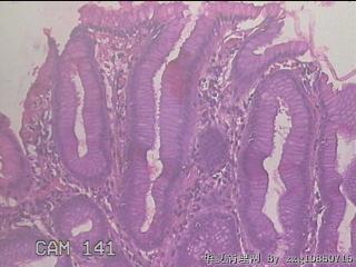 胃底体交界粘膜图3