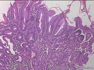 胃底体交界粘膜图18