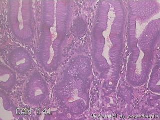 胃底体交界粘膜图15