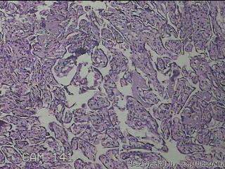 胎盘组织图16