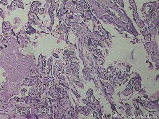 胎盘组织图14