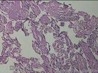 胎盘组织图9