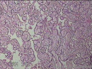 胎盘组织图21