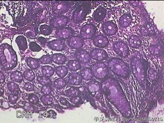 直肠粘膜图4