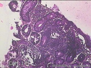 直肠粘膜图5