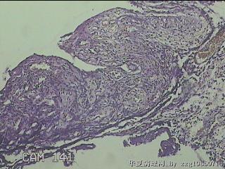 左侧乳腺组织图6