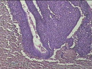 宫颈管组织图14