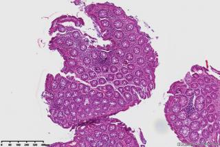 降结肠粘膜图4