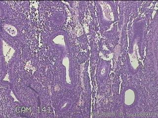 宫腔内膜组织图3