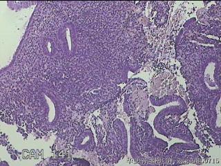 宫腔内膜组织图13