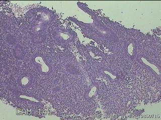 宫腔内膜组织图10
