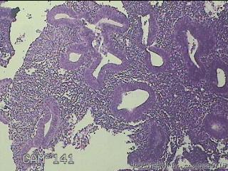 宫腔内膜组织图11