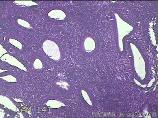 宫腔内膜组织图31