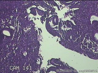 宫腔内膜组织图24