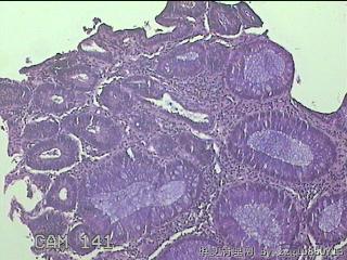 直肠粘膜图12
