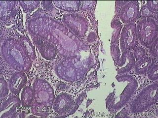 直肠粘膜图10