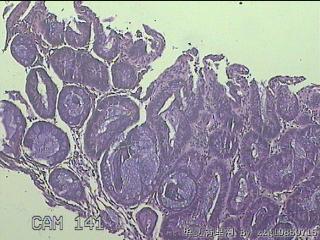 直肠粘膜图1
