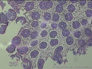 乙状结肠粘膜图2