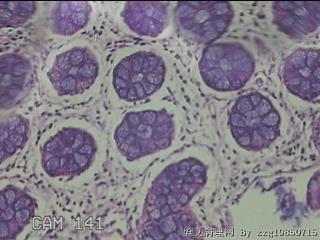 乙状结肠粘膜图5
