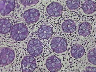 乙状结肠粘膜图6