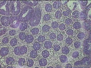 乙状结肠粘膜图1