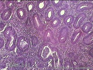 直肠粘膜图3