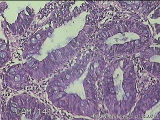 乙状结肠粘膜图8