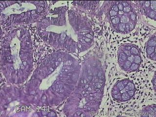 乙状结肠粘膜图7