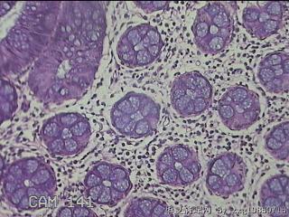 乙状结肠粘膜图4