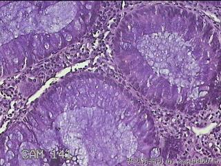 直肠粘膜图28