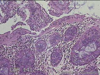 直乙结肠粘膜图18