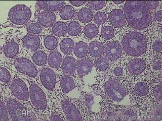 直乙结肠粘膜图3
