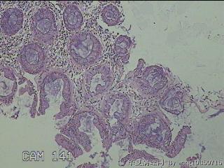 直乙结肠粘膜图8